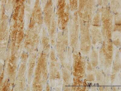 Immunohistochemistry-Paraffin: Cofilin 2 Antibody (6G9) [H00001073-M03]