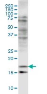 Western Blot: Cofilin 2 Antibody (6G9) [H00001073-M03]