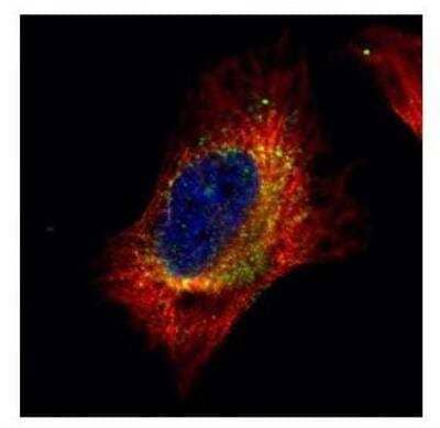 Immunocytochemistry/ Immunofluorescence: Cofilin 2 Antibody [NBP1-33570]