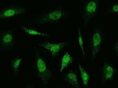 Immunocytochemistry/ Immunofluorescence: Cofilin 2 Antibody [NBP2-98910]