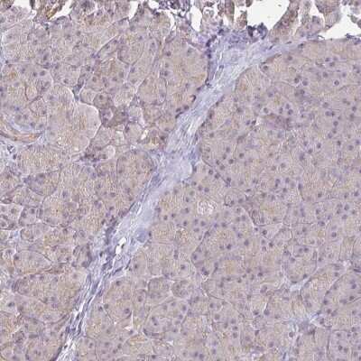 Immunohistochemistry-Paraffin: Cofilin 2 Antibody [NBP2-38544]