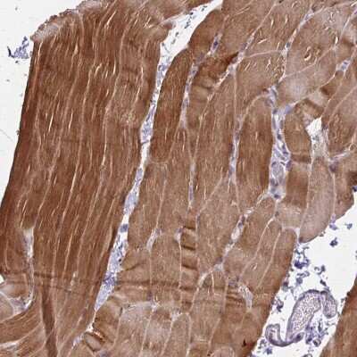 Immunohistochemistry-Paraffin: Cofilin 2 Antibody [NBP2-38544]