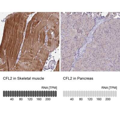 Immunohistochemistry-Paraffin: Cofilin 2 Antibody [NBP2-38544]