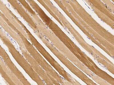 Immunohistochemistry-Paraffin: Cofilin 2 Antibody [NBP2-98909]