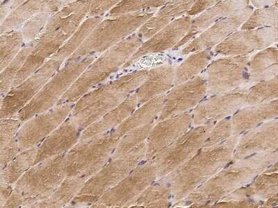 Immunohistochemistry-Paraffin: Cofilin 2 Antibody [NBP2-98910]