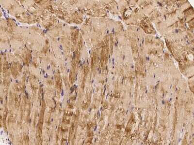 Immunohistochemistry-Paraffin: Cofilin 2 Antibody [NBP2-98910]
