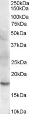 Western Blot: Cofilin 2 Antibody [NB600-800]