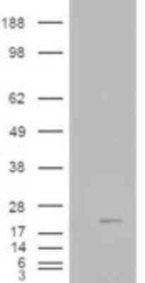 Western Blot: Cofilin 2 Antibody [NB600-800]