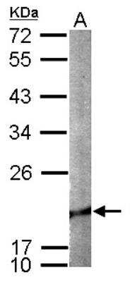 Western Blot: Cofilin 2 Antibody [NBP1-33570]