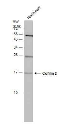 Western Blot: Cofilin 2 Antibody [NBP1-33570]