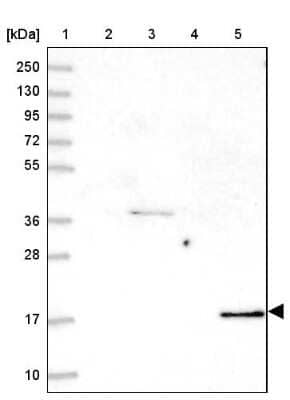 Western Blot: Cofilin 2 Antibody [NBP2-38544]