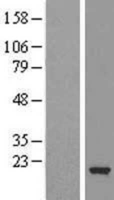 Western Blot: Cofilin 2 Overexpression Lysate [NBL1-09127]