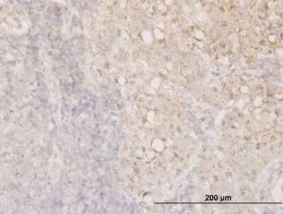 Immunohistochemistry-Paraffin: Cofilin Antibody (1A1) [H00001072-M04]
