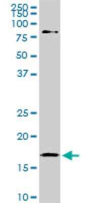 Western Blot: Cofilin Antibody (1A1) [H00001072-M04]