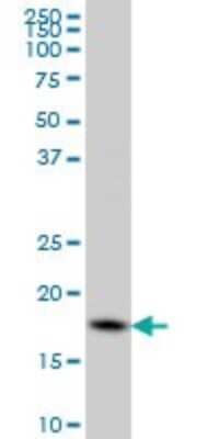 Western Blot: Cofilin Antibody (1A1) [H00001072-M04]