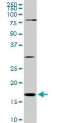Western Blot: Cofilin Antibody (1A1) [H00001072-M04]