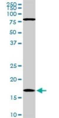 Western Blot: Cofilin Antibody (1A1) [H00001072-M04]