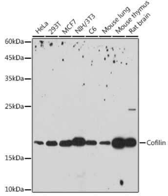 Western Blot: Cofilin Antibody (4M1Z9) [NBP3-16141]