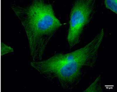 Immunocytochemistry/ Immunofluorescence: Cofilin Antibody (567) [NBP2-42828]