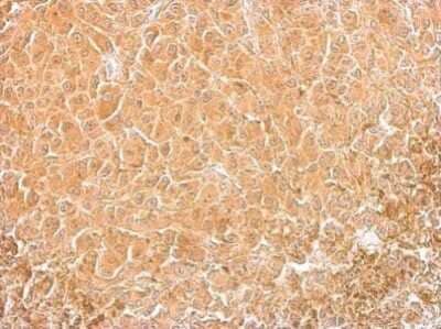 Immunohistochemistry-Paraffin: Cofilin Antibody (567) [NBP2-42828]