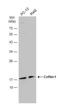 Western Blot: Cofilin Antibody (567) [NBP2-42828]