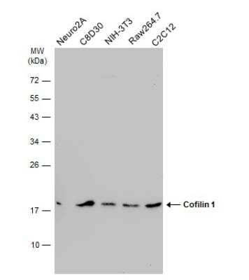 Western Blot: Cofilin Antibody (567) [NBP2-42828]