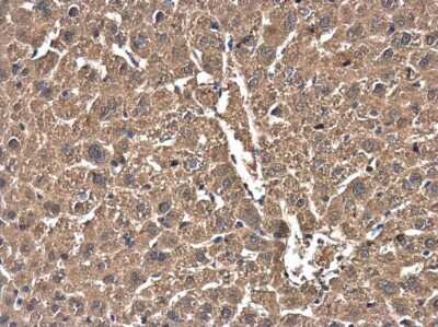 Immunohistochemistry-Paraffin: Cofilin Antibody (GT217) [NBP3-13520]