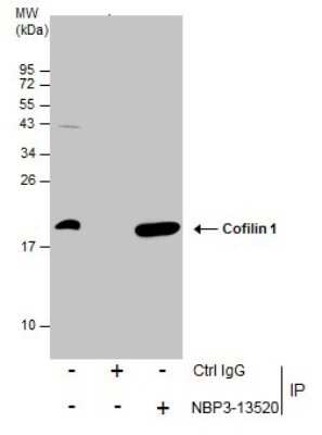 Immunoprecipitation: Cofilin Antibody (GT217) [NBP3-13520]