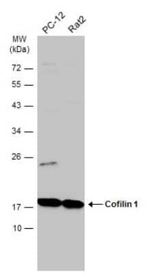 Western Blot: Cofilin Antibody (GT217) [NBP3-13520]