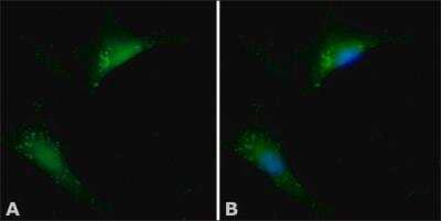 Immunocytochemistry/ Immunofluorescence: Cofilin Antibody [NB100-1900]