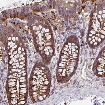 Immunohistochemistry: Cofilin Antibody [NBP2-49098]