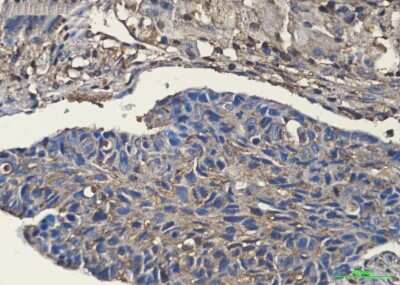 Immunohistochemistry: Cofilin Antibody (S06-2C0) [NBP3-15015]