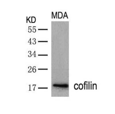 Western Blot: Cofilin Antibody [NB100-81866]