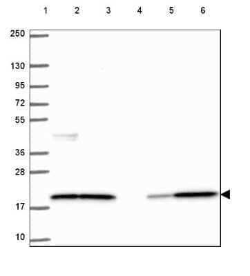 Western Blot: Cofilin Antibody [NBP2-49098]