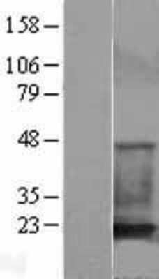 Western Blot: Cofilin Overexpression Lysate [NBL1-09126]