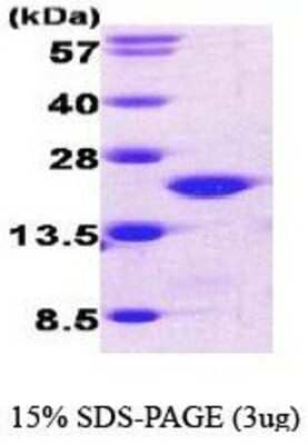 SDS-PAGE: Recombinant Human Cofilin His Protein [NBC1-18535]