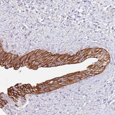 Immunohistochemistry: Coiled-Coil Domain Containing 149 Antibody [NBP2-30471]