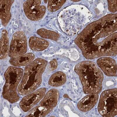 Immunohistochemistry: Coiled-Coil Domain Containing 149 Antibody [NBP2-30476]