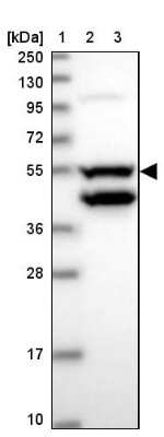 Western Blot: Coiled-Coil Domain Containing 149 Antibody [NBP2-30471]