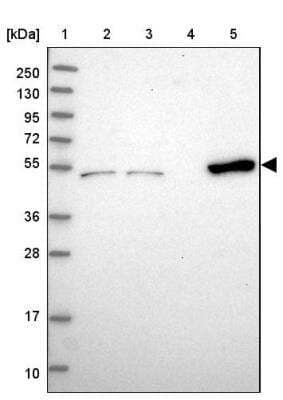 Western Blot: Coiled-Coil Domain Containing 149 Antibody [NBP2-30476]