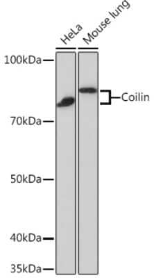 Western Blot: Coilin Antibody (7Z4K1) [NBP3-16196]