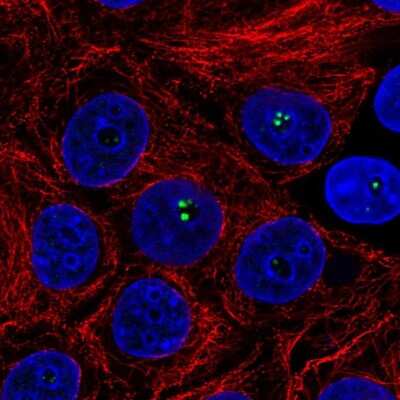 Immunocytochemistry/ Immunofluorescence: Coilin Antibody [NBP2-58668]