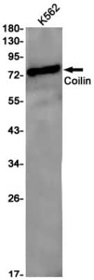 Western Blot: Coilin Antibody (S02-4B9) [NBP3-19608]