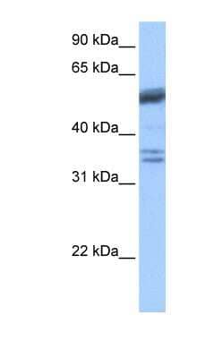 Western Blot: Coilin Antibody [NBP1-54669]