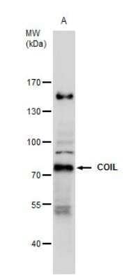 Western Blot: Coilin Antibody [NBP2-15939]