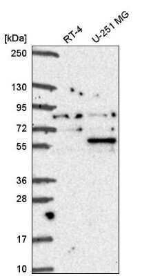 Western Blot: Coilin Antibody [NBP2-57887]