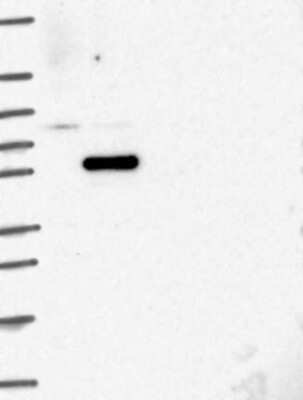 Western Blot: Coilin Antibody [NBP3-17696]