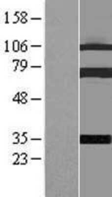 Western Blot: Coilin Overexpression Lysate [NBL1-09347]