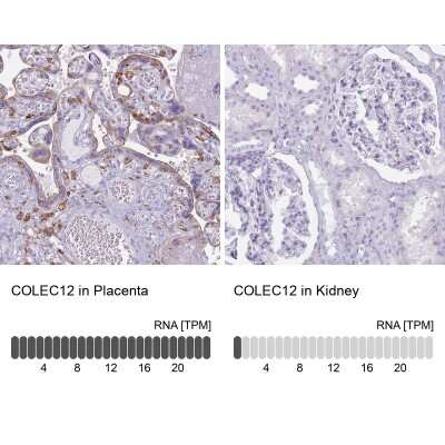 Immunohistochemistry-Paraffin: CL-P1/COLEC12 Antibody [NBP2-33508]