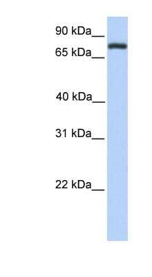 Western Blot: CL-P1/COLEC12 Antibody [NBP1-59015]